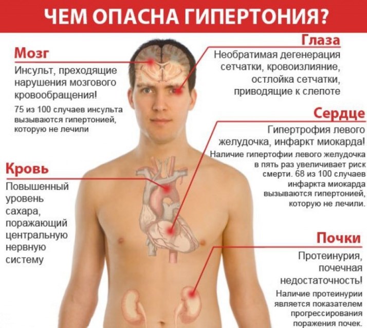 Артериальная гипертония осложнение профилактика